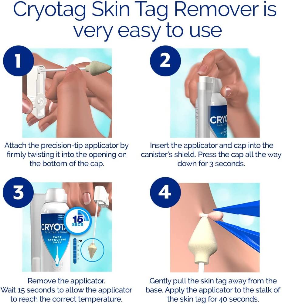 Cryotag Skin Tag Remover - Fast Effective Safe - Up to 12 Treatments