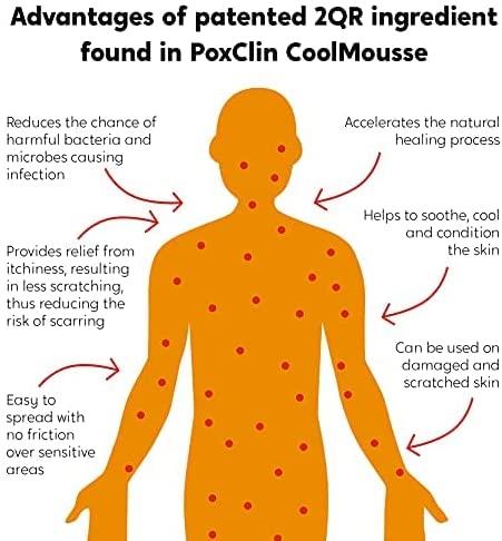 PoxClin Cool Mousse Chicken Pox - 100ml